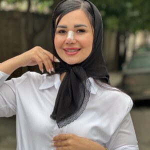 مینی اسکارف لبه توری ۹۵۹